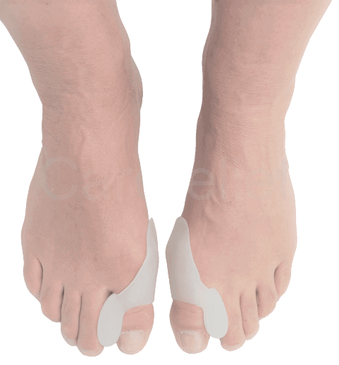 Knystbeskytter med tåskiller holder en øm storetå adskilt til næste tå, der vender indad, bøjer, krummer og overlapper. Køb 1 par tåspredere i blød silikone på Carerelief.dk.