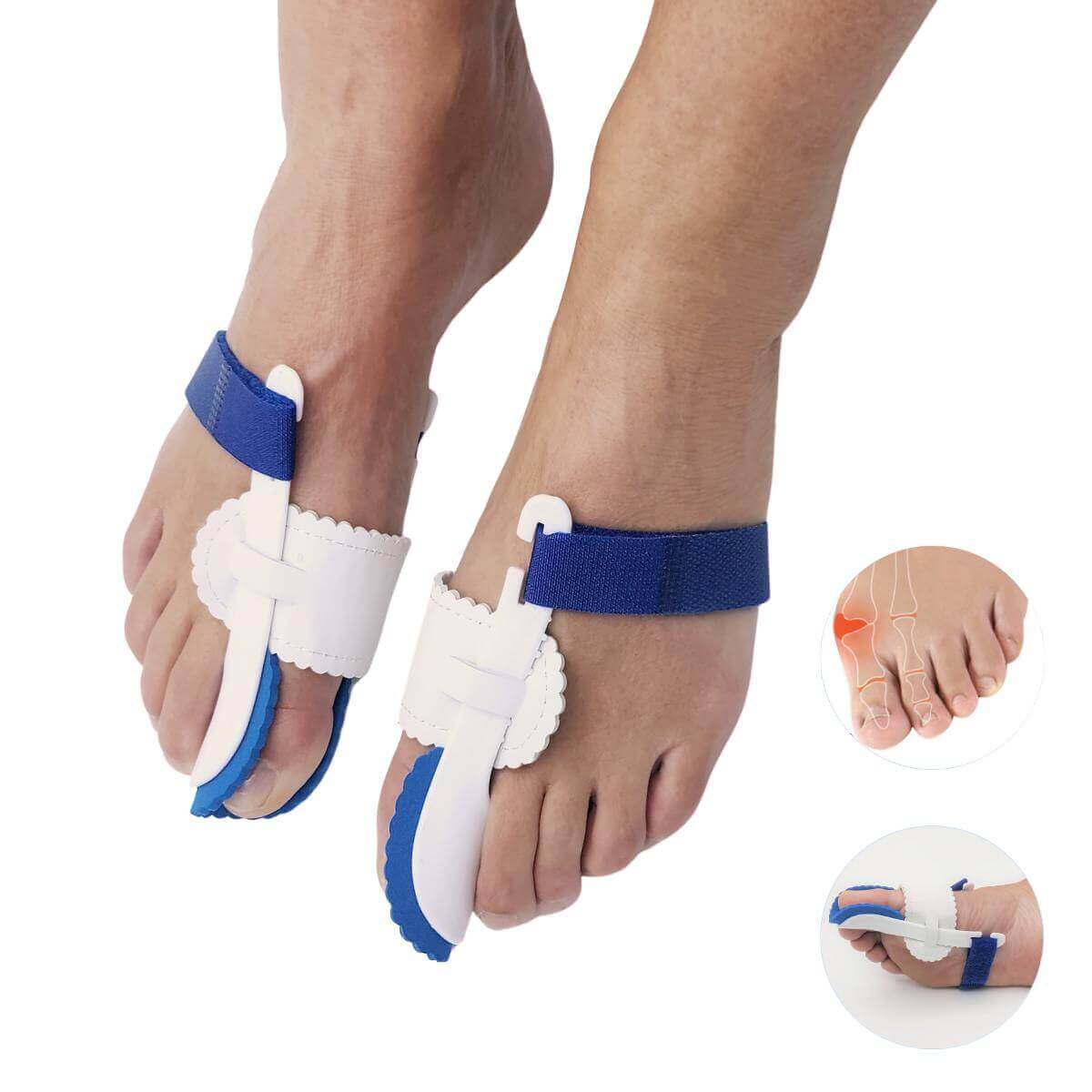 Justerbar natskinne til knyster med blød skumpolstring og velcro afhjælper smerter fra skæv storetå, forstuvet storetå og hammertå. Bestil 1 par hammertå skinne til storetåen ved hallux valgus billigt hos Carerelief.